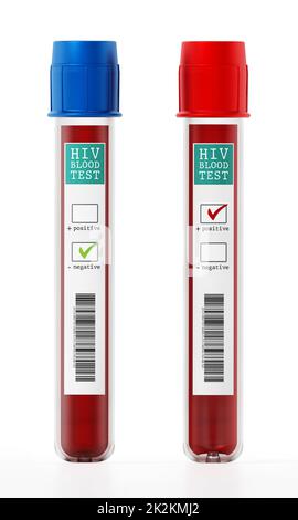 Échantillons de sang positifs et négatifs en flacons portant des étiquettes de test VIH. 3D illustration Banque D'Images