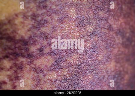 Femme asiatique sombre ecchymose sur les fesses d'un accident de glissement dans la salle de bains, vue rapprochée. Banque D'Images