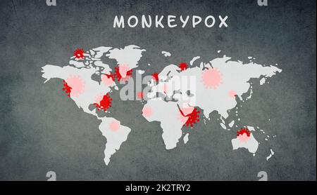 Carte du monde, la monkeypox est debout sur le fond texturé, l'épidémie du virus MPXV, la propagation de maladies infectieuses, la pandémie Banque D'Images