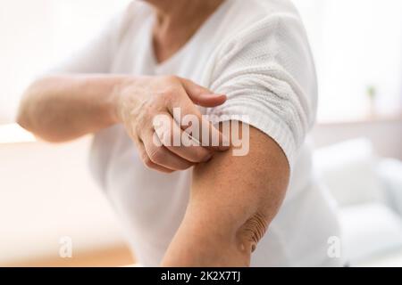 Femme rayant peau de corps de démangeaison Banque D'Images