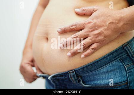 Femme asiatique montrer gros ventre de grande taille surpoids et l'obésité au bureau. Banque D'Images