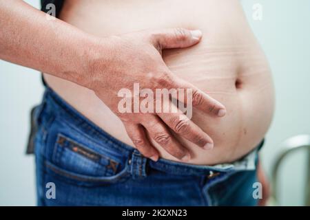 Asian woman show fat belly big size overweight and obesity at office. Stock Photo