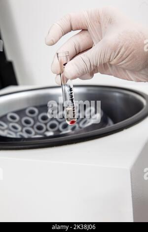 Tube à essai avec culot de cellules de moelle osseuse obtenu après centrifugation. Scientifique préparant des échantillons de moelle osseuse pour l'analyse cytométrique de flux en laboratoire Banque D'Images