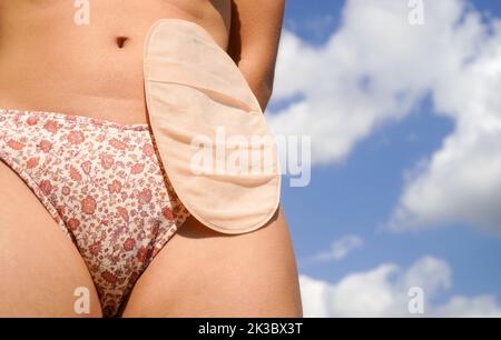 corps de femme avec sac d'ostomie dans le bikini avec le ciel dans l'arrière-plan Banque D'Images