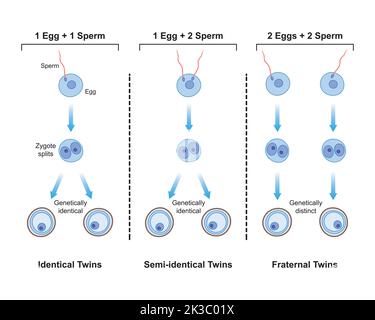 Conception scientifique des différences entre la formation de Twins monozygotes et dizygotes. Twins identiques et fraternels. Symboles colorés. Illustration du vecteur Illustration de Vecteur