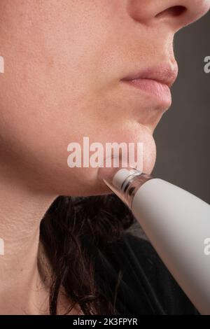 femme avec aspirateur pour pores du visage, soin de la peau. Banque D'Images