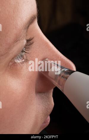 femme avec aspirateur pour pores du visage, soin de la peau. Banque D'Images