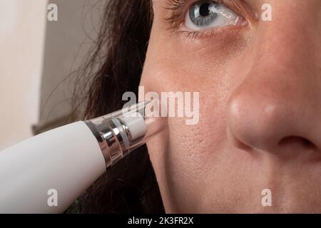 femme avec aspirateur pour pores du visage, soin de la peau. Banque D'Images