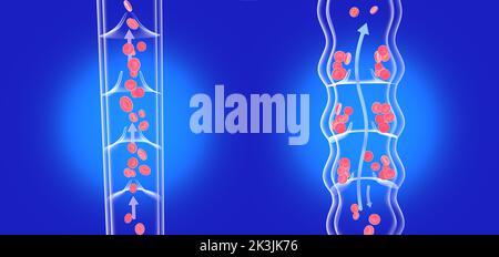 Illustration anatomique 3D de deux images, une veine incompétente malade à côté d'une veine saine. Image transparente du système circulatoire sanguin. Banque D'Images