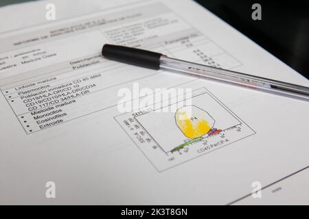 Rapport de test de cytométrie de flux du patient. Cytométrie en flux. Banque D'Images