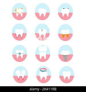 Ensemble d'icônes de dents. Illustration vectorielle de diverses maladies dentaires et de l'état des dents, comme des caries, des fissures, des fissures, des implants, gingivite, dent de sagesse pour Illustration de Vecteur