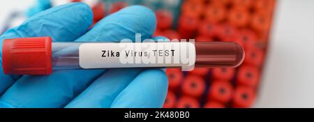 Test du virus Zika, image conceptuelle Banque D'Images