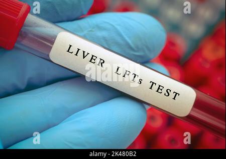 Test de la fonction hépatique, image conceptuelle Banque D'Images