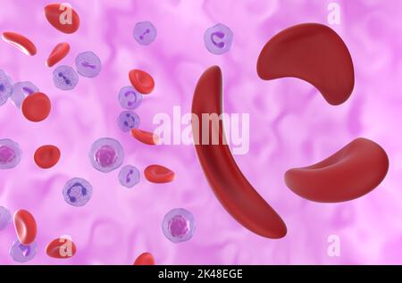 Cellules d'anémie falciforme (maladie de la faucille) dans le flux sanguin - vue isométrique 3D illustration Banque D'Images