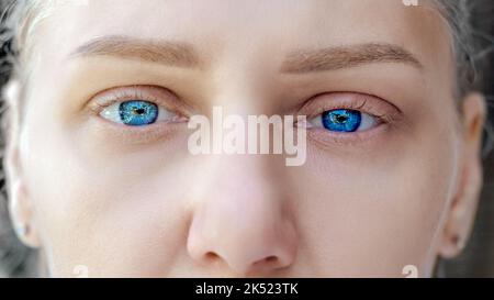 Gros plan des yeux bleus tristes et des paupières gonflées. Jeune belle blonde regarde dans l'appareil photo. Yeux de fille avec de longues belles cils. Gros plan de Banque D'Images