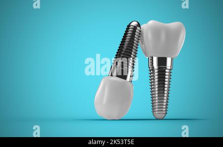 implants dentaires sur fond bleu. 3d rendu. Banque D'Images