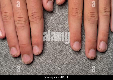 Ongles sales et longs avec des bavures, des doigts et des ongles d'enfant sur un fond gris, des ongles et de la saleté en détail et gros plan. Banque D'Images