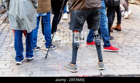 Hambourg, Allemagne. 04th octobre 2022. Un piéton avec deux cuisses prothétiques se dresse sur des pavés. Credit: Markus Scholz/dpa/Picture Alliance/dpa | Markus Scholz/dpa/Alay Live News Banque D'Images