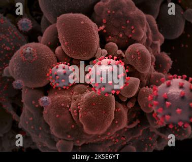 Nouveau coronavirus SRAS-COV-2. Micrographe électronique à balayage colorisé d'une cellule (rose) fortement infectée par des particules du virus du SRAS-COV-2 (bleu sarcelle et violet), isolée d'un échantillon de patient. Image capturée au NIAID Integrated Research Facility (IRF) à fort Detrick, Maryland. Une version composite unique optimisée et améliorée de six images de micrographe électronique à balayage, crédit : NIAID Banque D'Images