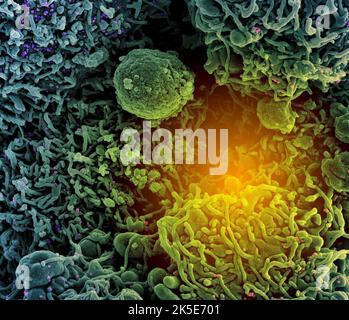 Nouveau coronavirus SRAS-COV-2. Micrographe électronique à balayage colorisé d'une cellule (sarcelle et verte) infectée par une souche variante de particules du virus SRAS-COV-2 (R.-U. B.1.1.7- violet et rose), isolée d'un échantillon de patient. Image capturée au NIAID Integrated Research Facility (IRF) à fort Detrick, Maryland. Une version composite unique optimisée et améliorée de six images de micrographe électronique à balayage, crédit : NIAID Banque D'Images