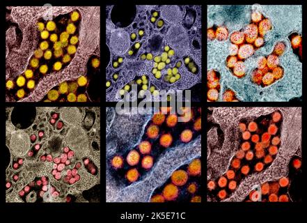 Un composite d'images du nouveau coronavirus SRAS-COV-2. Micrographes électroniques de transmission des particules du virus du SRAS-COV-2, isolés d'un patient. Une version composite unique optimisée et améliorée de six images de micrographe électronique à balayage, crédit : NIAID Banque D'Images