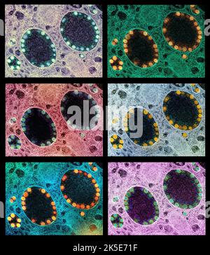 Nouvelles particules du coronavirus SRAS-COV-2. Un composite unique de 6 images de micrographe électronique de transmission de particules du virus du SRAS-COV-2 dans les endosomes d'une cellule épithéliale olfactive nasale fortement infectée. Images capturées à l'installation de recherche intégrée NIAID. Une version composite optimisée et améliorée unique de 6 images de micrographe électronique à balayage, crédit: NIAID / Alamy Live News Banque D'Images