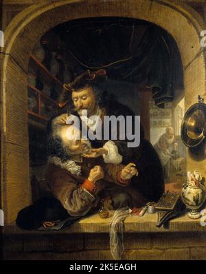 L'opération, entre 1663 et 1684. Banque D'Images