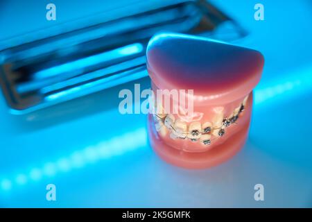 Gros plan du modèle de mâchoire avec bretelles. Outils orthodontiques Banque D'Images