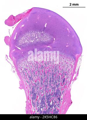 Micrographe à microscope à faible puissance montrant un os long en développement (fémur). En haut, l'épiphyse est faite par le cartilage hyaliné qui montre une initiale Banque D'Images