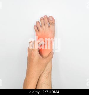 Un jeune homme asiatique se grattant le pied. Concept de maladies de la peau qui démangent telles que la gale, l'infection fongique, l'eczéma, le psoriasis, l'allergie, etc Banque D'Images