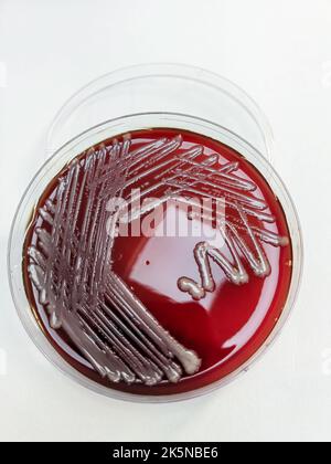 Une bactérie SARM staphylococcus aureus affichée sur une plaque de gélose au sang sur une surface blanche Banque D'Images