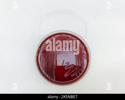 Une bactérie Staphylococcus aureus affichée sur une plaque de gélose au sang sur une surface blanche Banque D'Images