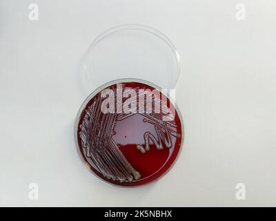 Une bactérie SARM staphylococcus aureus affichée sur une plaque de gélose au sang sur une surface blanche Banque D'Images