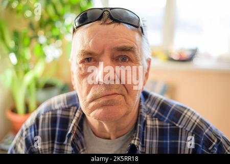 Homme âgé avec paralysie du nerf facial, paralysie de Bell. Banque D'Images