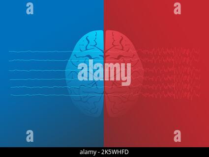 Illustration du cerveau normal humain et du cerveau épileptique. Ondes cérébrales de la crise focale. Illustration de Vecteur