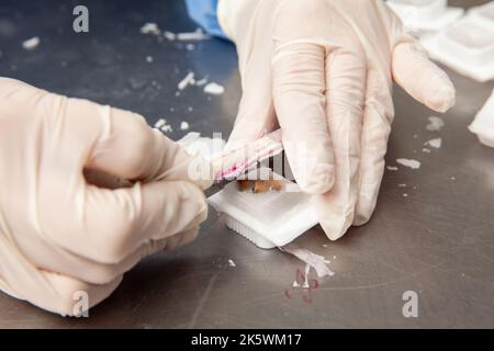 Scientifique préparant des blocs de paraffine contenant des tissus de biopsie pour la coupe. Laboratoire de pathologie. Diagnostic du cancer. Banque D'Images