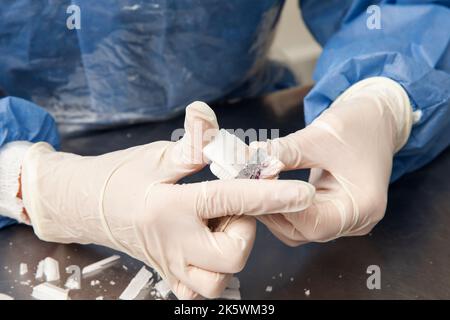 Scientifique préparant des blocs de paraffine contenant des tissus de biopsie pour la coupe. Laboratoire de pathologie. Diagnostic du cancer. Banque D'Images