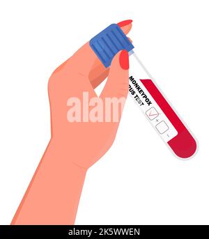 Tube d'échantillon de sang pour le vecteur de test du virus de la variole du singe. Test, tube de laboratoire avec du sang humain. Contrôle de test pour le virus de la variole du singe. Illustration de Vecteur