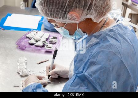 Scientifique préparant des blocs de paraffine contenant des tissus de biopsie pour la coupe. Laboratoire de pathologie. Diagnostic du cancer. Banque D'Images