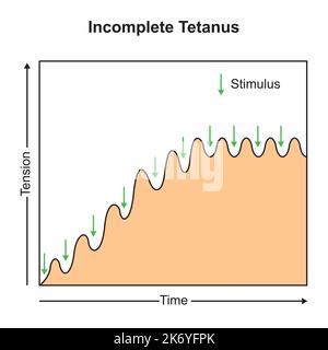 Conception scientifique du tétanos incomplet. Symboles colorés. Illustration vectorielle. Illustration de Vecteur