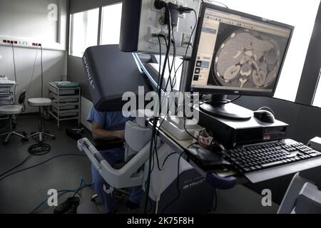 Chirurgie robotique à l'hôpital Lyon Sud - salle d'opération pendant la chirurgie robotique à l'hôpital Lyon Sud. Le patient atteint du syndrome de 'casse-noisette' subit une greffe de rein entièrement réalisée par un chirurgien aux commandes d'un robot chirurgical.©PHOTOPQR/LE PROGRES/photo Maxime Jegat - opération chirurgicale robotisée à l'hôpital Lyon Sud -le 'poste de pilotage' (à gauche) du robot avec fente 3D pour la visualisation, commande de type « joystick » pour la précision. Ce poste de commande, adaptable aux gabarits, est disponible au niveau du bruit de chambre dans le meilleur Banque D'Images