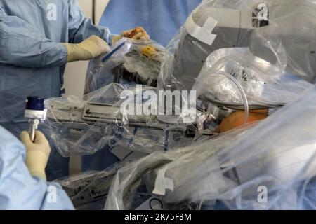 Chirurgie robotique à l'hôpital Lyon Sud - salle d'opération pendant la chirurgie robotique à l'hôpital Lyon Sud. Le patient atteint du syndrome de 'nutcracker' subit une greffe de rein entièrement réalisée par un chirurgien aux commandes d'un robot chirurgical.©PHOTOPQR/LE PROGRES/photo Maxime Jegat - opération chirurgicale robotisée à l'hôpital Lyon Sud -installation du robot pour l'opération chirurgicale robotisée à l'Hôpital Lyon Sud. La patiente attestation du syndrome de 'casse-noisette' subie a auto greffe of rein entièrement realised by a murgien aux commandes d'un ro Banque D'Images