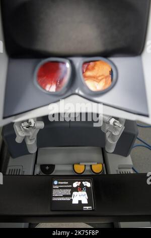 Chirurgie robotique à l'hôpital Lyon Sud - salle d'opération pendant la chirurgie robotique à l'hôpital Lyon Sud. Le patient atteint du syndrome de 'casse-noisette' subit une greffe de rein entièrement réalisée par un chirurgien aux commandes d'un robot chirurgical.©PHOTOPQR/LE PROGRES/photo Maxime JEGAT - opération chirurgicale robotisée à l'hôpital Lyon Sud -la poste de pilotage du robot avec lunette 3D visualisation, type de joystick pour la précision. Ce poste de commande, adaptable aux gabarits, permet de faire appel à la chirurgie de l'équipement de mesure conditio Banque D'Images