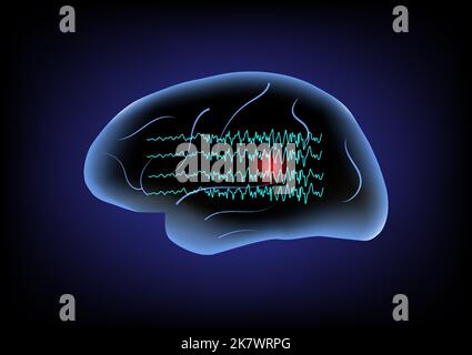 Illustration du cerveau humain et des ondes cérébrales. Concept de saisie focale. Illustration de Vecteur