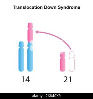 Conception scientifique du syndrome de translocation vers le bas de Robertsonian. Symboles colorés. Illustration vectorielle. Illustration de Vecteur