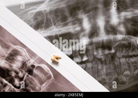 L'image panoramique montre plusieurs dents imbriquées et affectées comme sur la partie supérieure, les dents des enfants, la dent extraite se trouve dans les images Banque D'Images