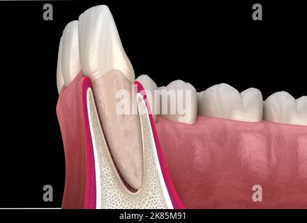 Morphologie de la dent et de la gomme de l'incisive latérale maxillaire. Illustration dentaire 3D précise sur le plan médical Banque D'Images