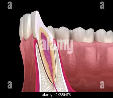 Anatomie de la dent et de la gomme de l'incisive latérale maxillaire (coupe transversale). Illustration dentaire 3D précise sur le plan médical Banque D'Images