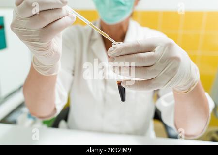 Analyse du plasma sanguin. L'assistant de laboratoire tient un tube à essai avec du sang d'une veine dans ses mains et le regarde. Test sanguin en laboratoire Banque D'Images