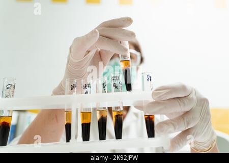 Analyse du plasma sanguin. L'assistant de laboratoire tient un tube à essai avec du sang d'une veine dans ses mains et le regarde. Test sanguin en laboratoire Banque D'Images